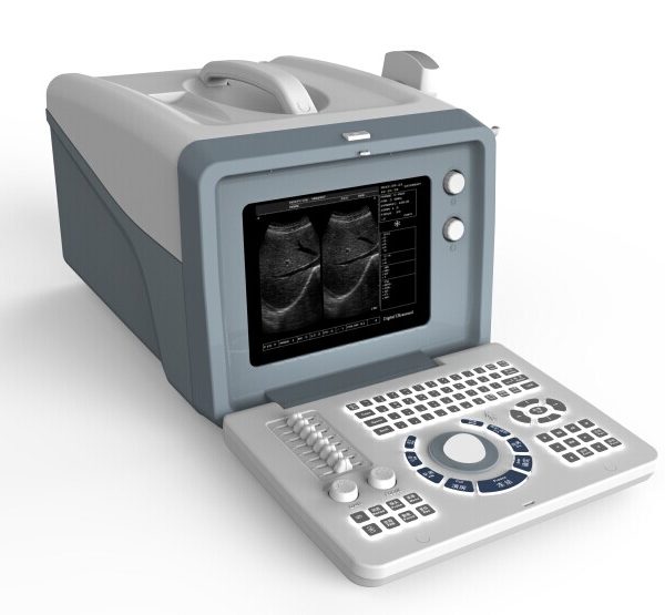 Ultrasound Imaging Systems