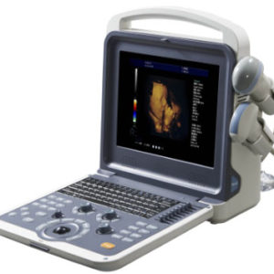 B Ultrasound Scanner