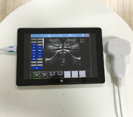 MP-UP03 USB probe ultrasound scanner