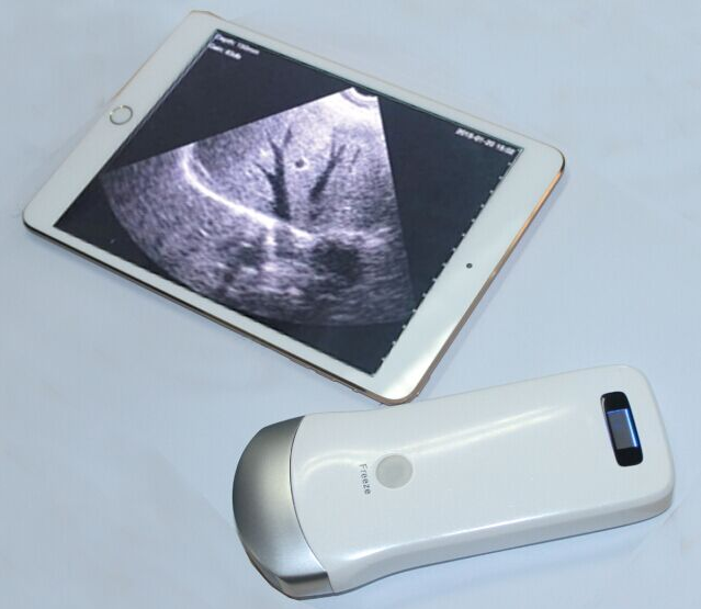 MP-UP02 wireless probe ultrasound scanner